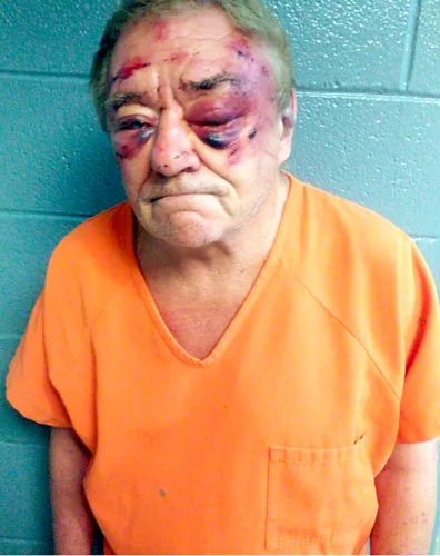 Legality of detention in police beating incident challenged